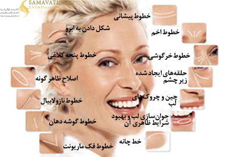 c-_users_mohammad_desktop_izadi_40