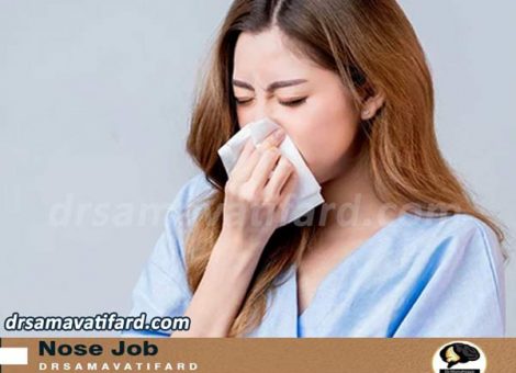 سرماخوردگی بعد از عمل بینی