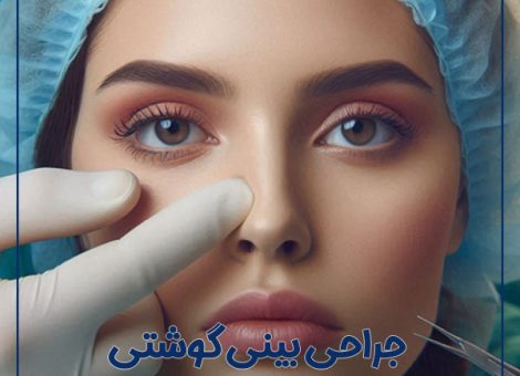 fleshy-nose-rhinoplasty