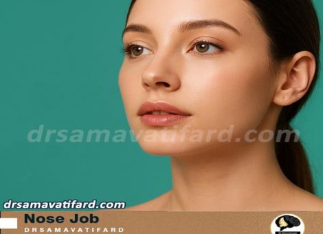 جراحی بینی طبیعی - دکتر محمدرضا سماواتی فرد