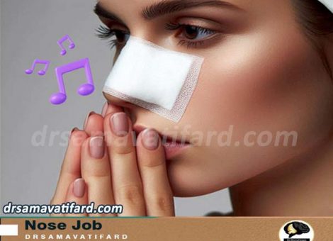 nose-whistling-after-surgery