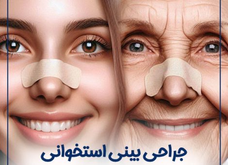 rhinoplasty-age