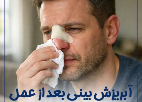 runny-nose-after-surgery-2