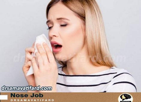 عطسه بعد از جراحی بینی