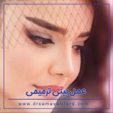 عمل بینی ترمیمی در تهران | دکتر سماواتی فرد