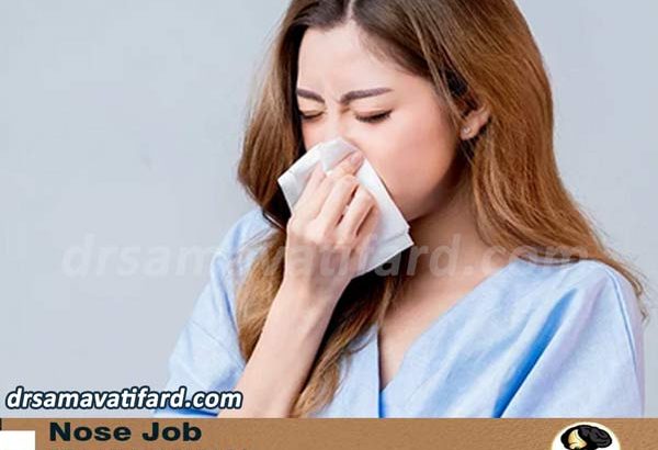 سرماخوردگی بعد از عمل بینی