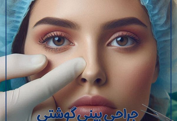 fleshy-nose-rhinoplasty