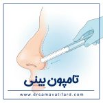 nasal-tampon-2