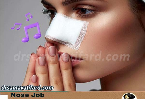 nose-whistling-after-surgery
