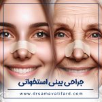 rhinoplasty-age