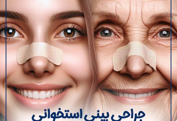 rhinoplasty-age