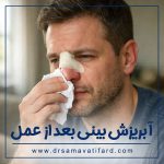 runny-nose-after-surgery-2