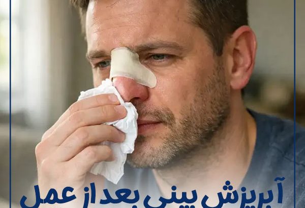 runny-nose-after-surgery-2