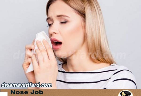 عطسه بعد از جراحی بینی